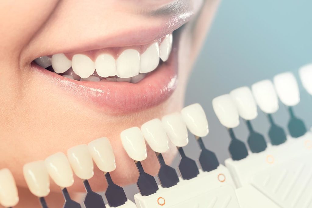 Cosmetic Dentistry Advanced Dental Care of Anderson Cosmetic Dentistry in Anderson from Dr. Jay Elbrecht