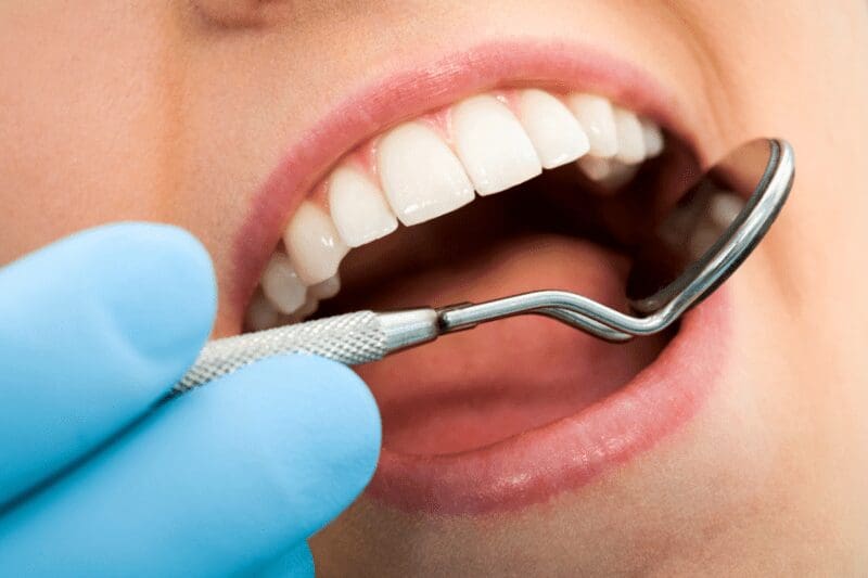 Mercury Free Dental Fillings Advanced Indiana Anderson IN