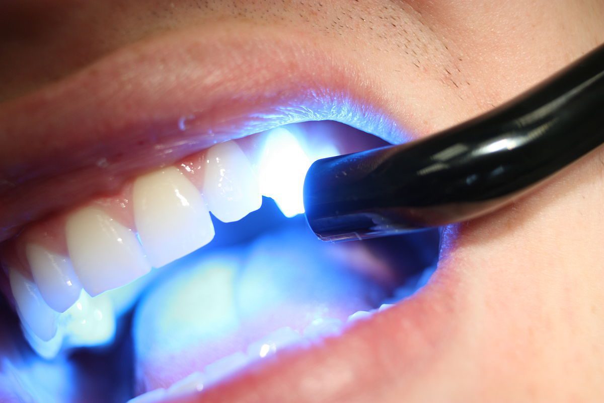 restorative dentistry anderson