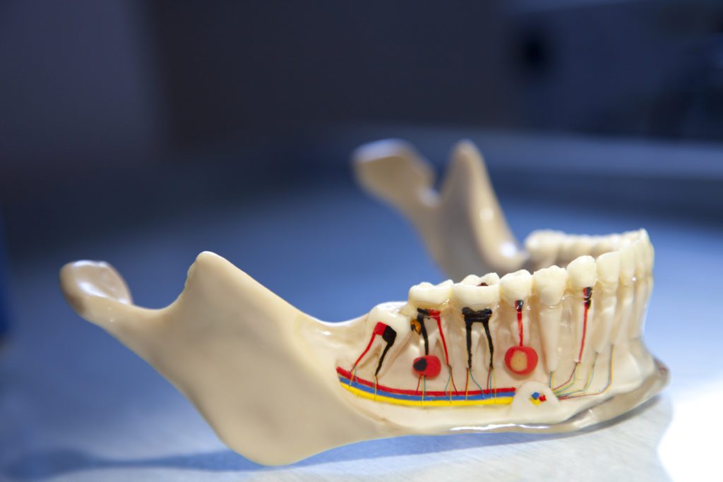 root-canal-therapy-anderson root canal therapy anderson