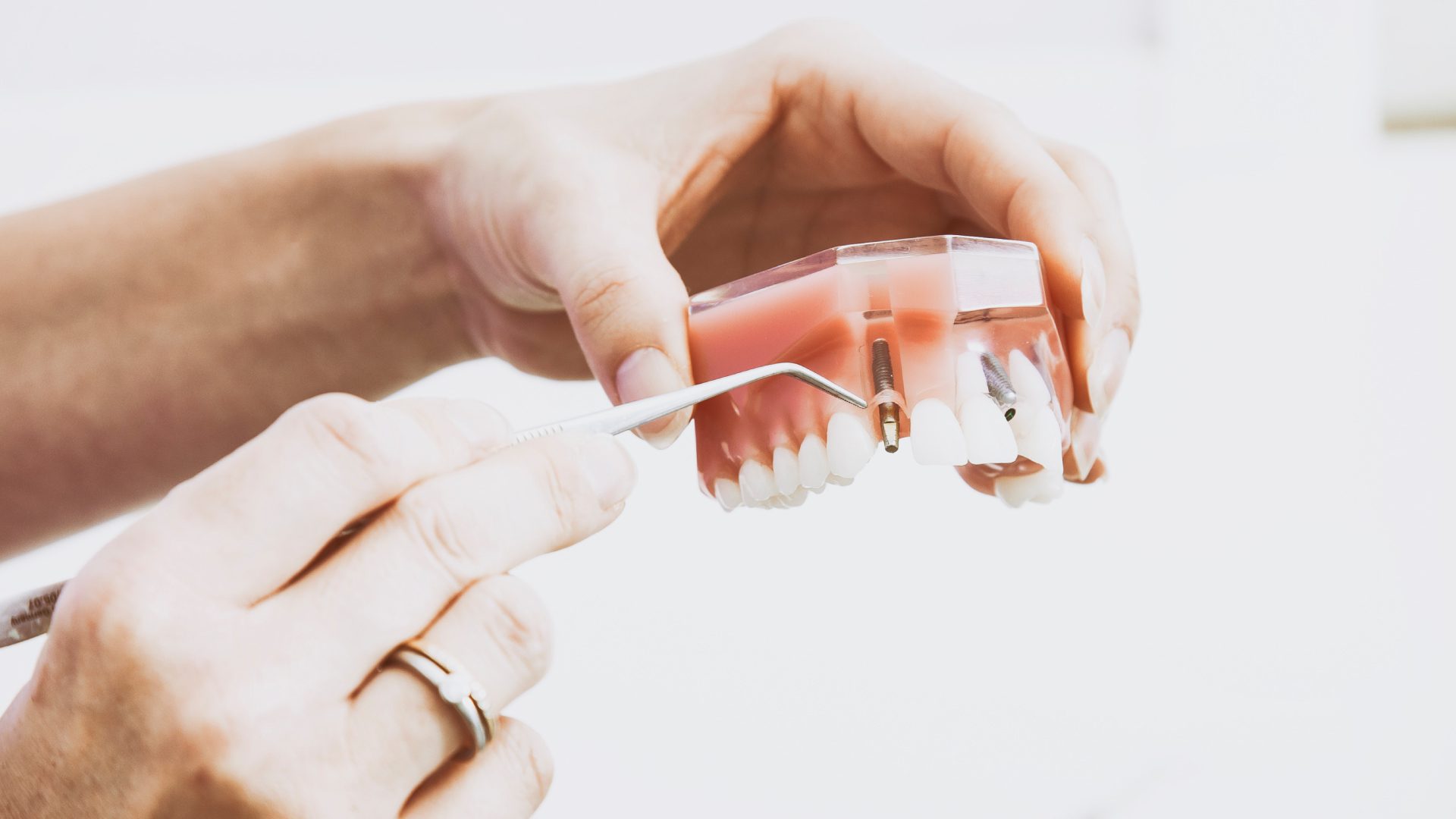 woman looking at dental implant up close