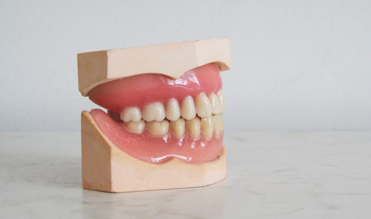 What is Dental Implant Restoration? Advanced Indiana