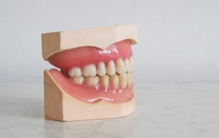 Dentures