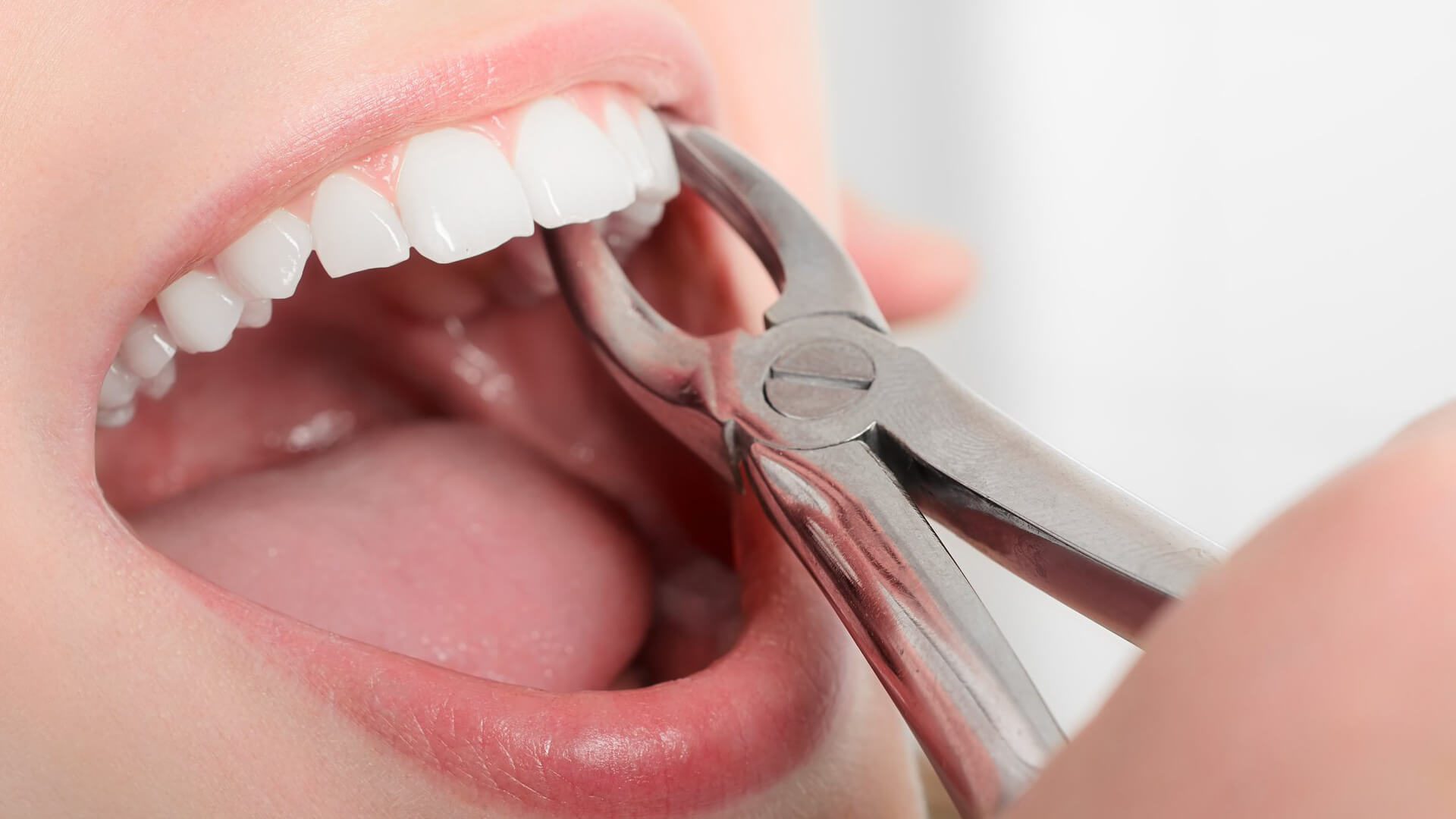 a woman getting a tooth extraction