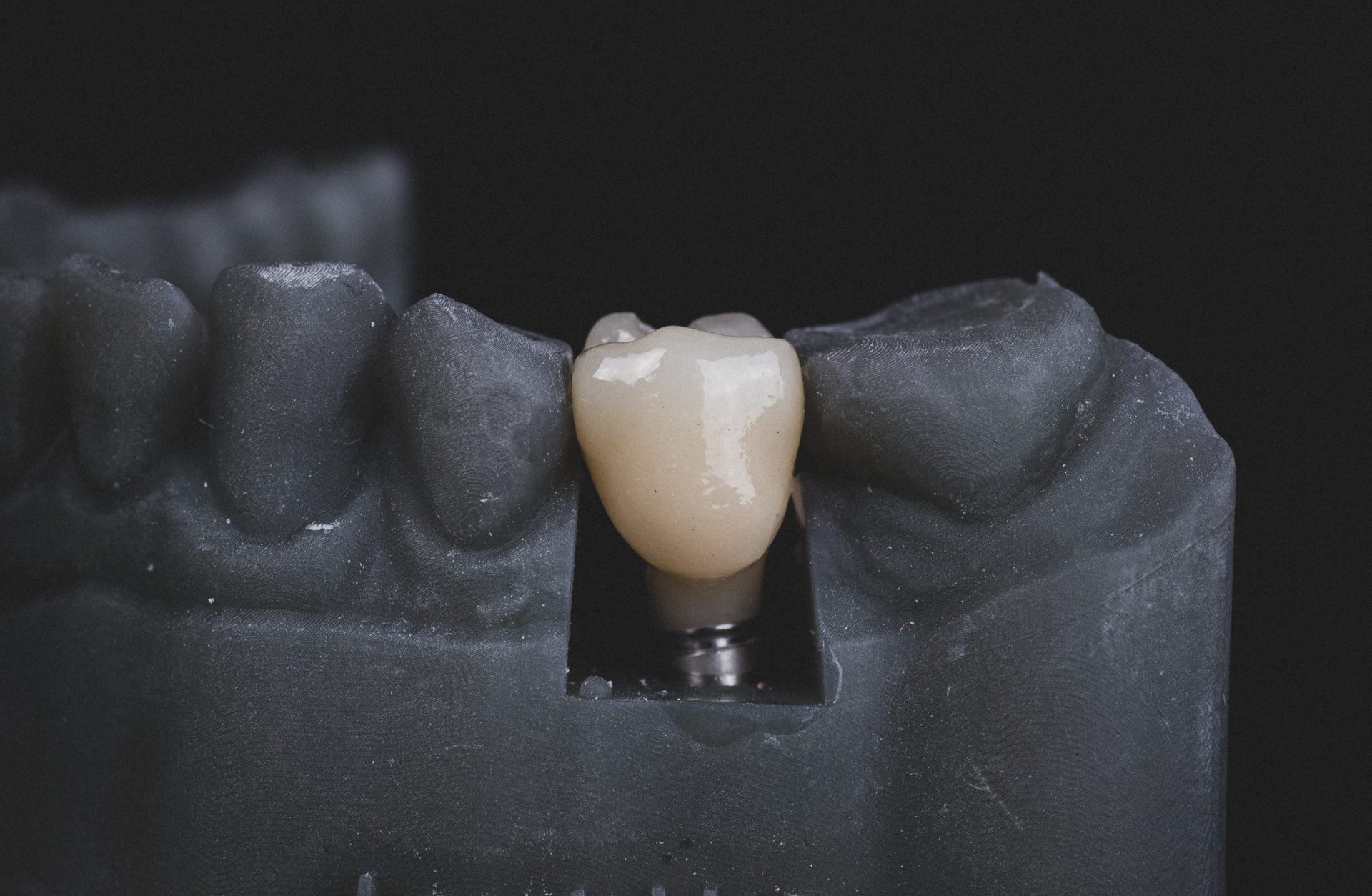 dental implant in black and white