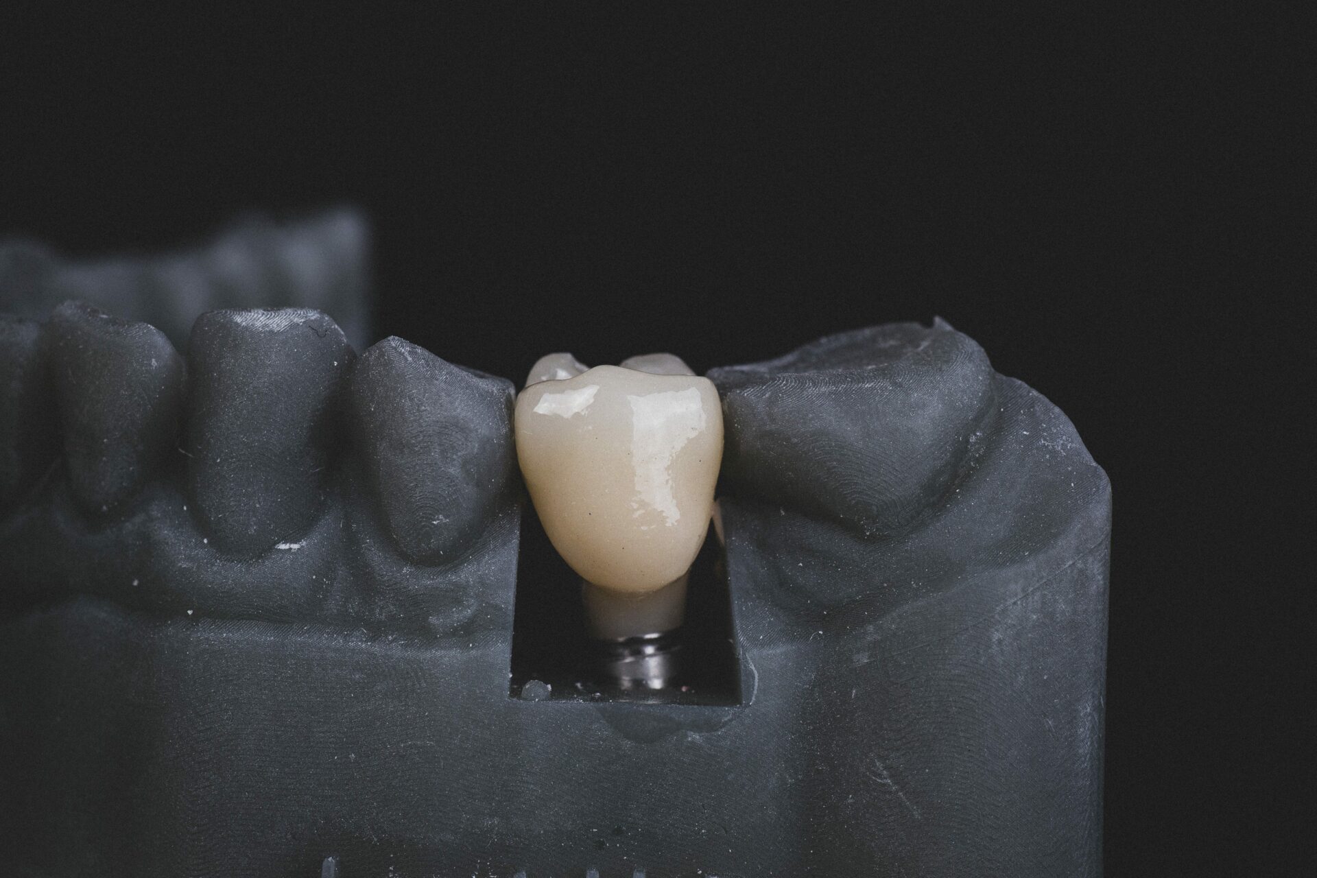 Dental implant in black and white