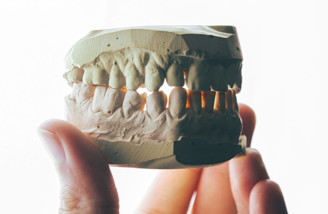 teeth mold held in hand