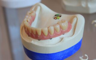 Denture