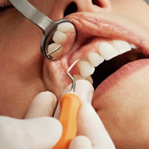 woman getting gums checked
