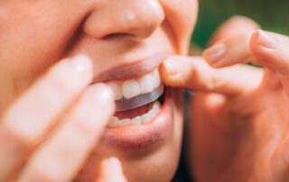 Woman Using Whitening Stipes or Whitestrips. Whitening Teeth at Home