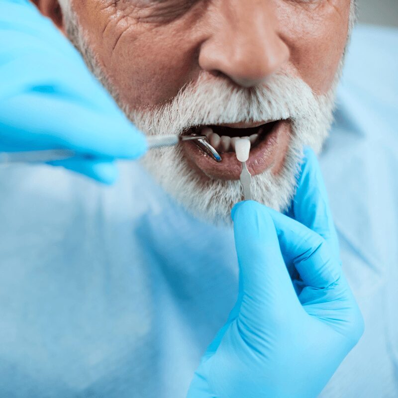 elderly man getting fitted for veneers