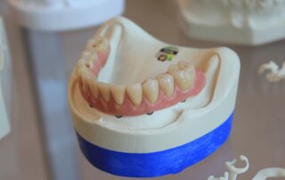 bottom jaw dentures in dentists office