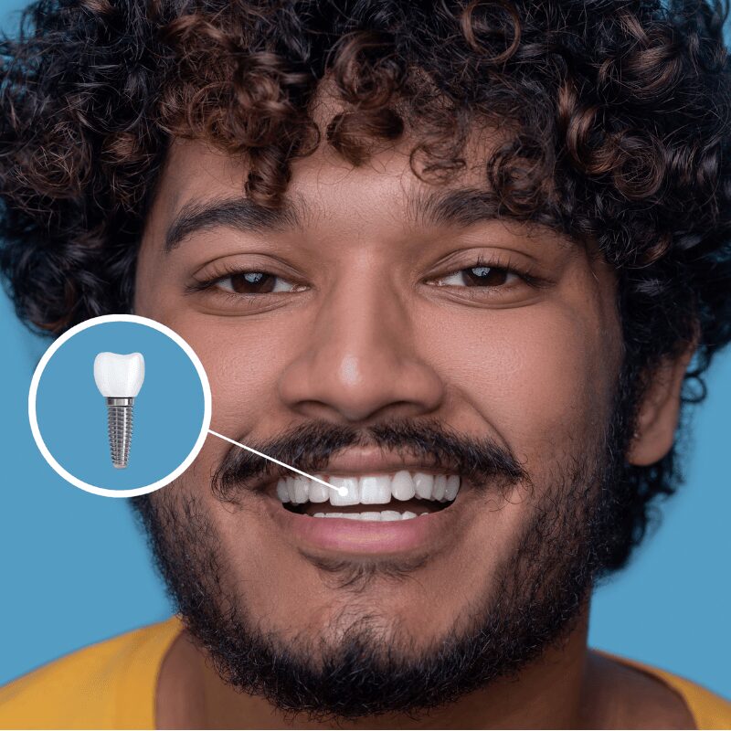 man smiling, bright white teeth man smiling bright