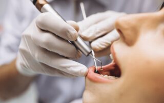 dentist performing dental filling procedure