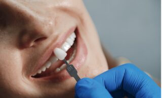 dentist checking temporary dental crown compatibility