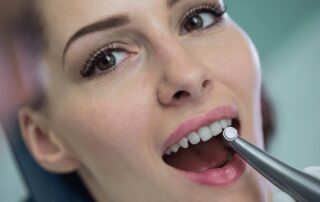 dental patient wondering composite veneers cost