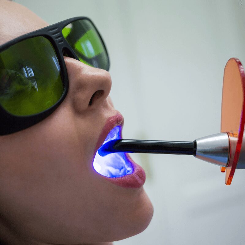 teeth whitening procedure