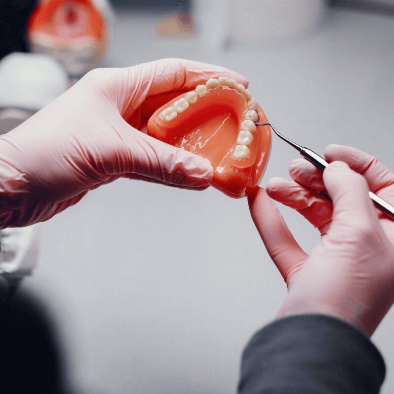 other tooth options, dentures