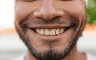 man smiling with brown, yellowish stains on teeth