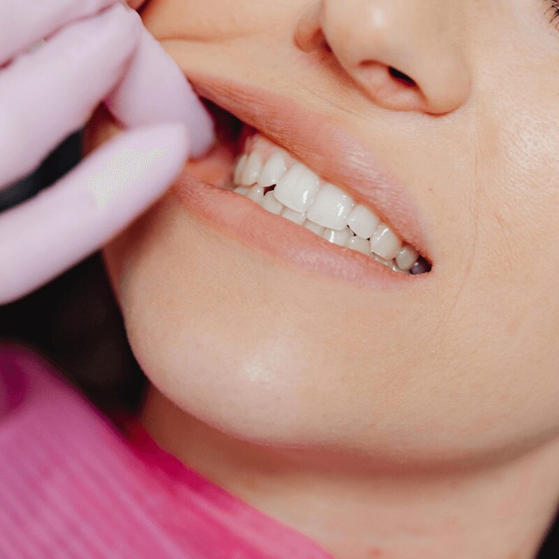 woman having oral examination