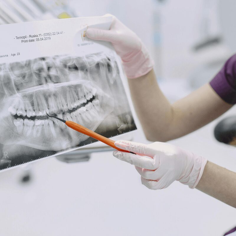 dentist-explaining-the-x-ray-result