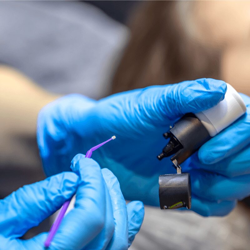 dentist applying dental bonding agent to do teeth filling
