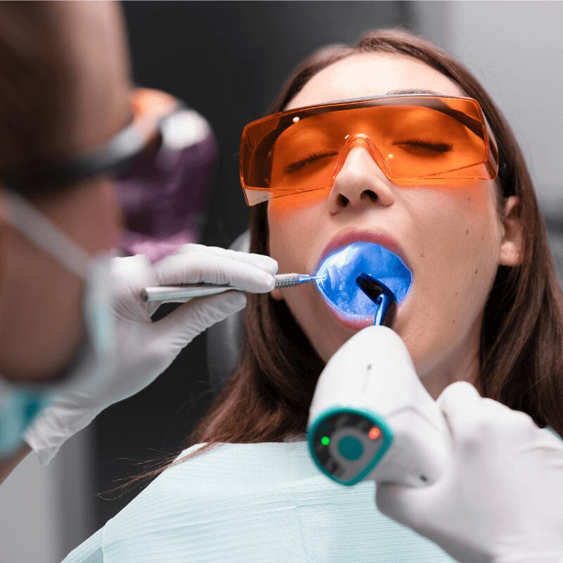 dentist shines uv light to harden tooth filling