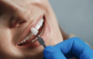 best material for tooth crown