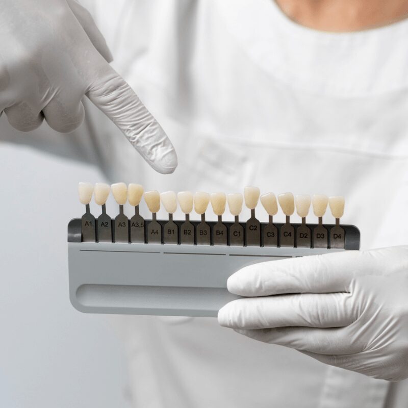 close-up-dentist-shows tooth crown variations and shades