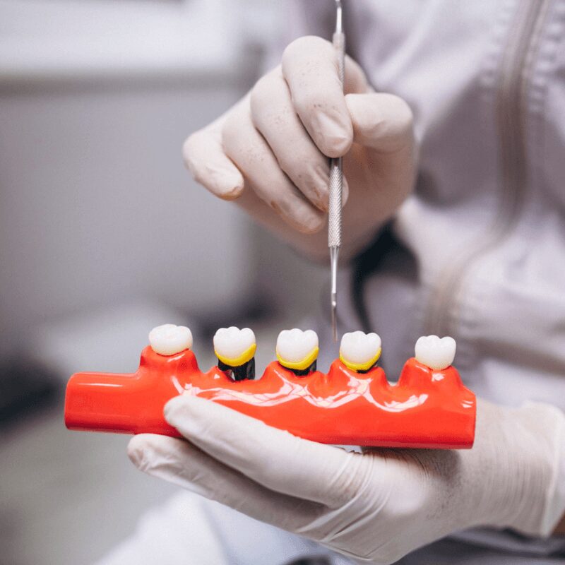 dentist-explaining tooth crown materials and types