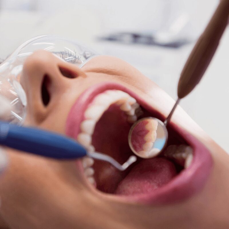 dentist-whiting-teethdentist-whiting-teeth