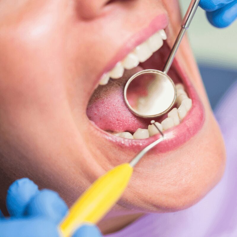 dentist examines female patient teeth dentist examines female patient teeth