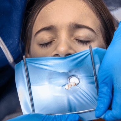 dentist installs a rubber dam for root canal treatment, isolate impacted tooth